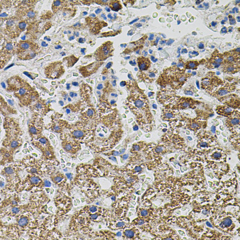 Immunohistochemistry of paraffin-embedded Human liver damage using NTF3 Polyclonal Antibody