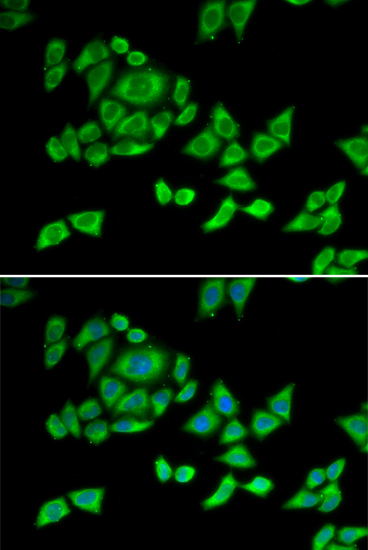 Immunofluorescence analysis of U2OS cells using OGDH Polyclonal Antibody