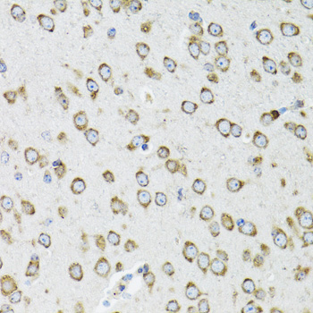 Immunohistochemistry of paraffin-embedded Mouse brain using OGDH Polyclonal Antibody at dilution of  1:100 (40x lens).