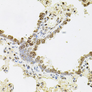 Immunohistochemistry of paraffin-embedded Rat lung using REG3A Polyclonal Antibody