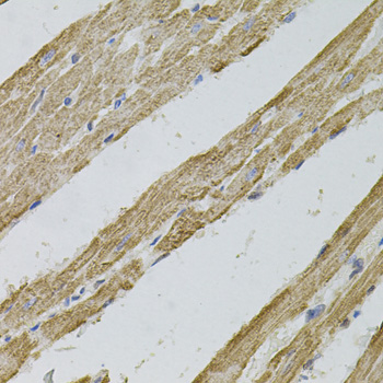 Immunohistochemistry of paraffin-embedded Rat heart using REG3A Polyclonal Antibody