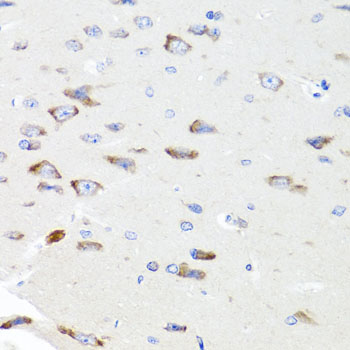 Immunohistochemistry of paraffin-embedded Rat brain using PIK3CA Polyclonal Antibody at dilution of  1:100 (40x lens).