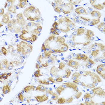 Immunohistochemistry of paraffin-embedded Human stomach using PIK3CA Polyclonal Antibody at dilution of  1:100 (40x lens).