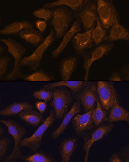 Immunofluorescence analysis of U-2 OS cells using SHMT1 Polyclonal Antibody at dilution of  1:100. Blue: DAPI for nuclear staining.