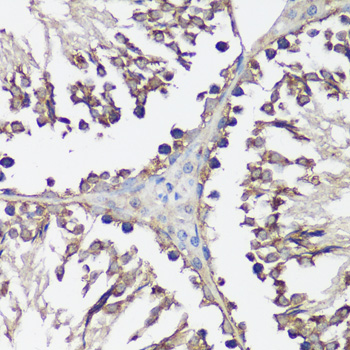 Immunohistochemistry of paraffin-embedded Rat testis using VAMP2 Polyclonal Antibody at dilution of  1:100 (40x lens).