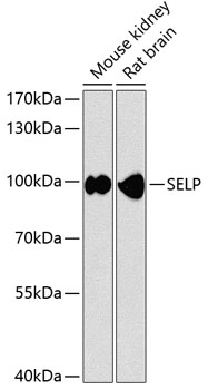 Western blot analysis of extracts of various cell lines using SELP Polyclonal Antibody at dilution of 1:1000.