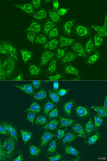 Immunofluorescence analysis of U2OS cells using UBE2A Polyclonal Antibody at dilution of  1:100. Blue: DAPI for nuclear staining.