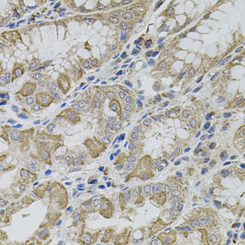 Immunohistochemistry of paraffin-embedded Human stomach using VIP Polyclonal Antibody