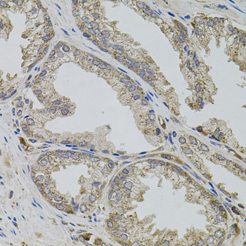 Immunohistochemistry of paraffin-embedded Human prostate using VIP Polyclonal Antibody