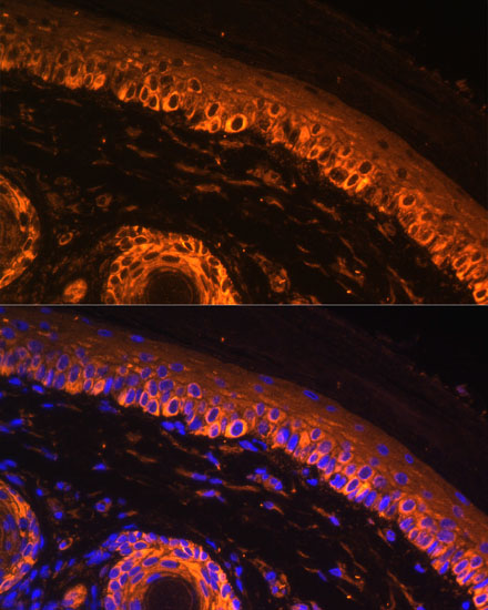 Immunofluorescence analysis of Rat skin using TYR Polyclonal Antibody at dilution of  1:100. Blue: DAPI for nuclear staining.