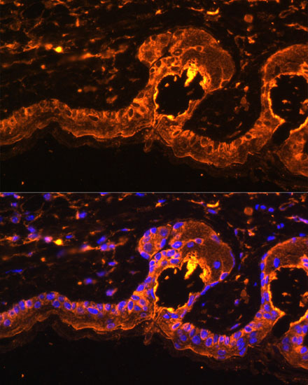 Immunofluorescence analysis of Mouse skin using TYR Polyclonal Antibody at dilution of  1:100. Blue: DAPI for nuclear staining.