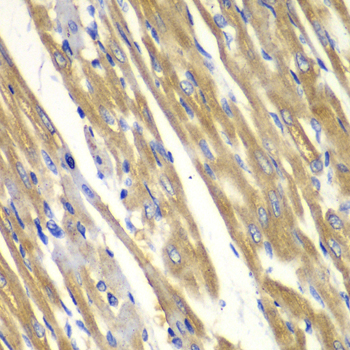 Immunohistochemistry of paraffin-embedded Rat heart using TYR Polyclonal Antibody at dilution of  1:100 (40x lens).