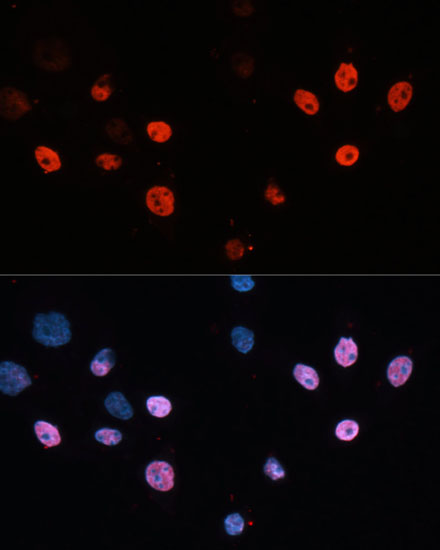 Immunofluorescence analysis of HeLa cells using HDAC3 Polyclonal Antibody at dilution of  1:100 (40x lens). Blue: DAPI for nuclear staining.