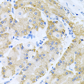 Immunohistochemistry of paraffin-embedded Human stomach using HDAC3 Polyclonal Antibody at dilution of  1:100 (40x lens).