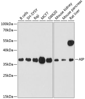 Western blot analysis of extracts of various cell lines using AIP Polyclonal Antibody at dilution of 1:1000.