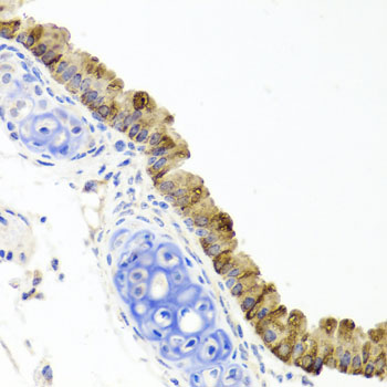 Immunohistochemistry of paraffin-embedded Mouse lung using TOPBP1 Polyclonal Antibody at dilution of  1:100 (40x lens).