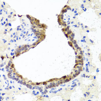 Immunohistochemistry of paraffin-embedded Rat lung using TOPBP1 Polyclonal Antibody at dilution of  1:100 (40x lens).