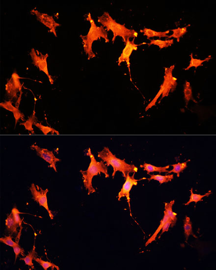 Immunofluorescence analysis of C6 cells using SIRT2 Polyclonal Antibody at dilution of  1:100 (40x lens). Blue: DAPI for nuclear staining.