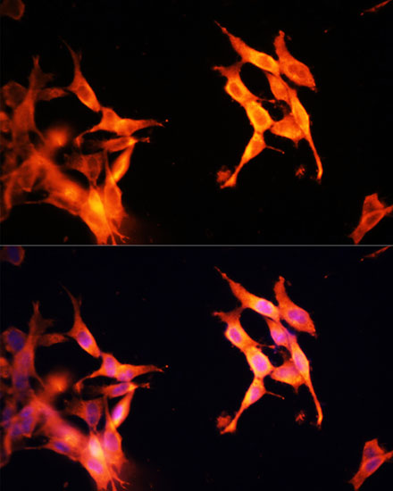 Immunofluorescence analysis of NIH-3T3 cells using SIRT2 Polyclonal Antibody at dilution of  1:100 (40x lens). Blue: DAPI for nuclear staining.