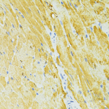 Immunohistochemistry of paraffin-embedded Mouse heart using SIRT2 Polyclonal Antibody at dilution of  1:100 (40x lens).