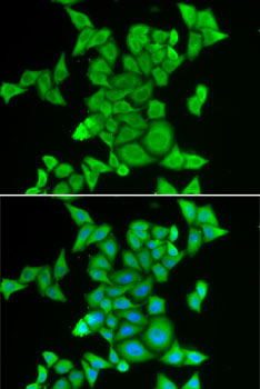 Immunofluorescence analysis of MCF7 cells using STRN3 Polyclonal Antibody