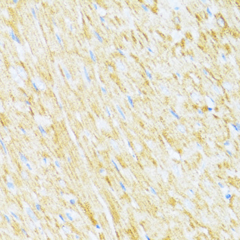 Immunohistochemistry of paraffin-embedded Rat heart using UQCR10 Polyclonal Antibody at dilution of  1:100 (40x lens).