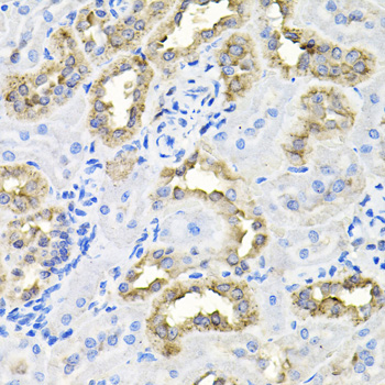 Immunohistochemistry of paraffin-embedded Rat kidney using CDCA8 Polyclonal Antibody at dilution of  1:100 (40x lens).