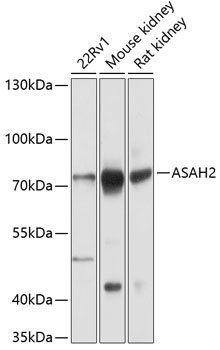 Western blot analysis of extracts of various cell lines using ASAH2 Polyclonal Antibody at dilution of 1:1000.