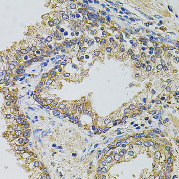 Immunohistochemistry of paraffin-embedded Human prostate using Gm13125 Polyclonal Antibody at dilution of  1:100 (40x lens).