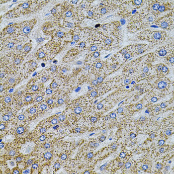 Immunohistochemistry of paraffin-embedded Human liver damage using Gm13125 Polyclonal Antibody at dilution of  1:100 (40x lens).