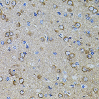 Immunohistochemistry of paraffin-embedded Rat brain using Gm13125 Polyclonal Antibody at dilution of  1:100 (40x lens).