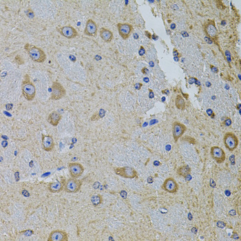 Immunohistochemistry of paraffin-embedded Mouse brain using Gm13125 Polyclonal Antibody at dilution of  1:100 (40x lens).