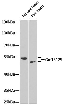 Western blot analysis of extracts of various cell lines using Gm13125 Polyclonal Antibody at dilution of 1:1000.