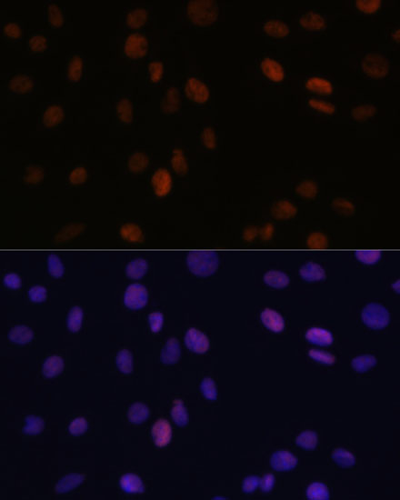 Immunofluorescence analysis of C6 cells using PSME3 Polyclonal Antibody at dilution of  1:100 (40x lens). Blue: DAPI for nuclear staining.