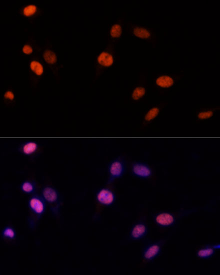 Immunofluorescence analysis of NIH-3T3 cells using PSME3 Polyclonal Antibody at dilution of  1:100 (40x lens). Blue: DAPI for nuclear staining.