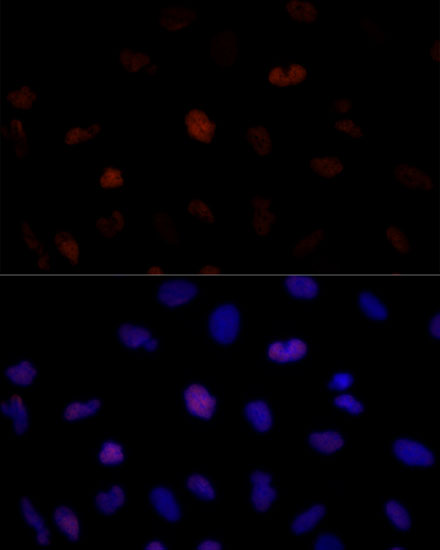 Immunofluorescence analysis of U-2 OS cells using PSME3 Polyclonal Antibody at dilution of  1:100 (40x lens). Blue: DAPI for nuclear staining.