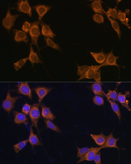 Immunofluorescence analysis of NIH/3T3 cells using CD133 Polyclonal Antibody at dilution of  1:100. Blue: DAPI for nuclear staining.