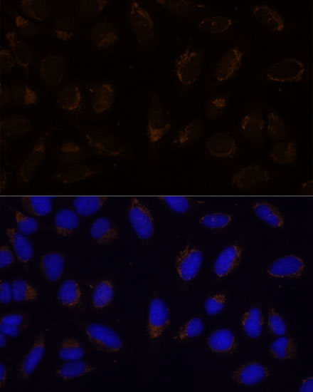 Immunofluorescence analysis of U-2 OS cells using CD133 Polyclonal Antibody at dilution of  1:100. Blue: DAPI for nuclear staining.