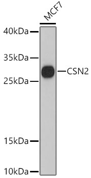 Western blot analysis of extracts of MCF7 cells using CSN2 Polyclonal Antibody at dilution of 1:3000.