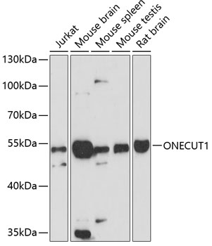 Western blot analysis of extracts of various cell lines using ONECUT1 Polyclonal Antibody at dilution of 1:3000.