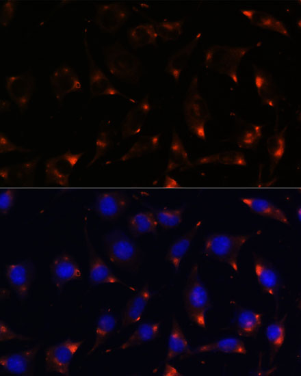 Immunofluorescence analysis of L929 cells using NOS1 Polyclonal Antibody at dilution of  1:100. Blue: DAPI for nuclear staining.