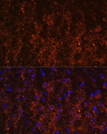 Immunofluorescence analysis of Mouse brain using SNX13 Polyclonal Antibody at dilution of  1:100. Blue: DAPI for nuclear staining.