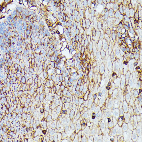 Immunohistochemistry of paraffin-embedded Human esophageal using HLA-B Polyclonal Antibody at dilution of  1:100 (40x lens).