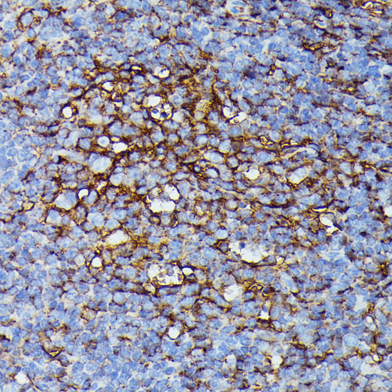 Immunohistochemistry of paraffin-embedded Mouse spleen using HLA-B Polyclonal Antibody at dilution of  1:100 (40x lens).