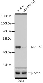 Western blot analysis of extracts from normal (control) and NDUFS2 knockout (KO) 293T cells using NDUFS2 Polyclonal Antibody at dilution of 1:3000.