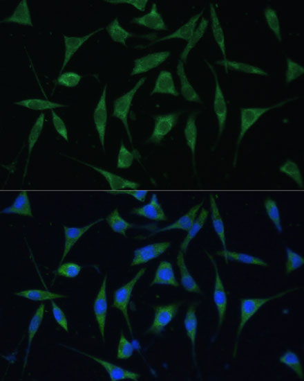 Immunofluorescence analysis of L929 cells using PALD1 Polyclonal Antibody at dilution of  1:100 (40x lens). Blue: DAPI for nuclear staining.