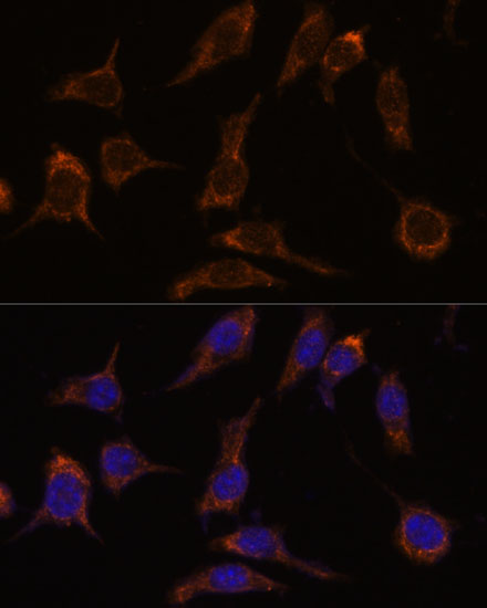 Immunofluorescence analysis of L929 cells using SCGN Polyclonal Antibody at dilution of  1:100. Blue: DAPI for nuclear staining.