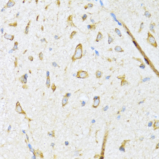 Immunohistochemistry of paraffin-embedded Mouse spinal cord using DNAJB11 Polyclonal Antibody at dilution of  1:100 (40x lens).