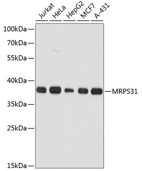 Western blot analysis of extracts of various cell lines using MRPS31 Polyclonal Antibody at dilution of 1:3000.