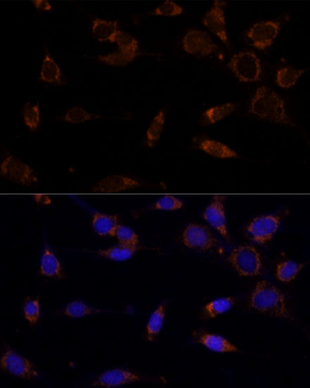 Immunofluorescence analysis of NIH-3T3 cells using MTCH2 Polyclonal Antibody at dilution of  1:100 (40x lens). Blue: DAPI for nuclear staining.